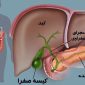 لوزالمعدهکیسه صفرادستگاه گوارش 85x85